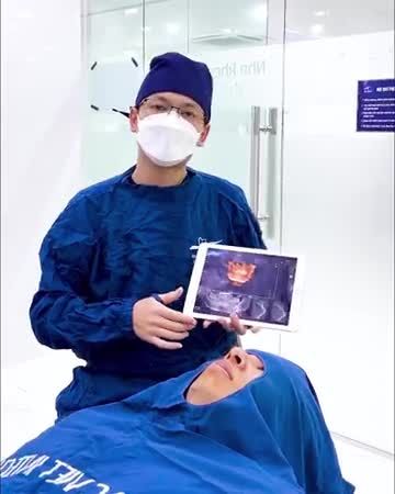 Bạn Nguyễn Quang Huy (SN 1998) là một vị khách hàng trẻ tuổi, đến với Nha khoa Lạc Việt Intech trong tình trạng viêm nhiễm nặng ở răng 21, dẫn tới viêm tủy và lan sang cả các răng bên cạnh.