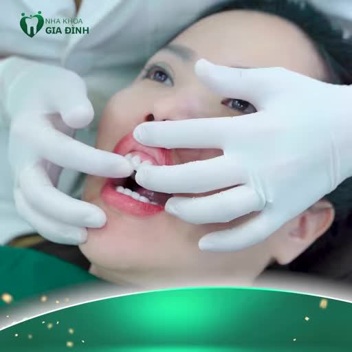 THÁNG NÀY CHỈ CÒN 30 SUẤT THẨM MỸ RĂNG SỨ ƯU ĐÃI TỚI 69%