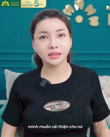 Sở hữu nụ cười đều đẹp trắng sáng như mong đợi nhờ lựa chọn đúng nha khoa uy tín, chị Nguyễn Vân Anh hạnh phúc chia sẻ: