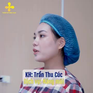 Cùng xem lí do tại sao khách hàng Trần Thu Cúc lại quyết định lựa chọn Tiến sĩ Thẩm mỹ, Bác sĩ Tống Hải để nâng mũi nhé