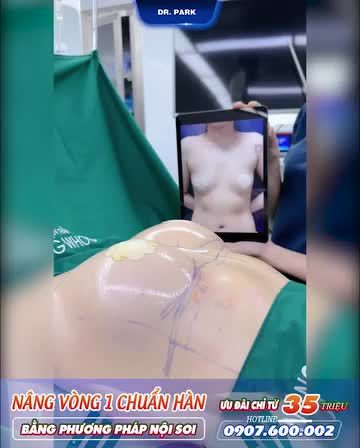 NÂNG NGỰC NỘI SOI ĐƯỜNG NÁCH CÓ AN TOÀN KHÔNG?