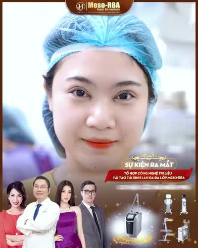 Cơ hội cắt mí hoàn toàn miễn phí, chỉ còn 4 ngày đăng kí tham dự sự kiện siêu HOT
