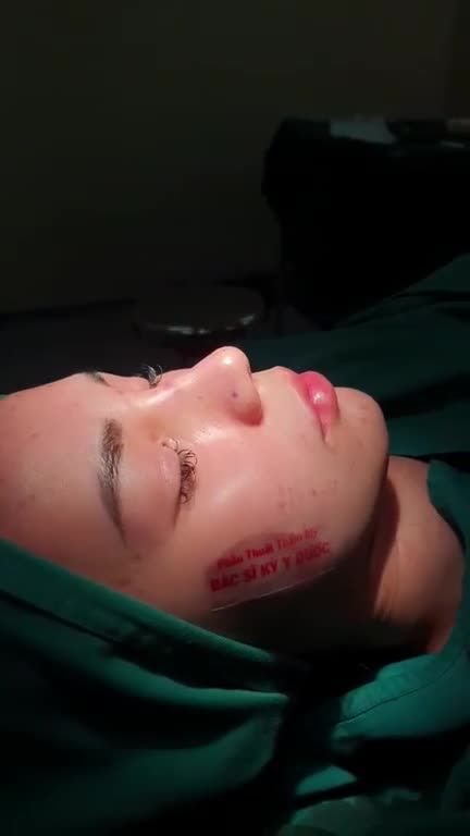 3 tiêu chí khi thực hiện phẫu thuật Nâng Mũi ALINE của Bác Sỹ Kỳ Y Dược:
