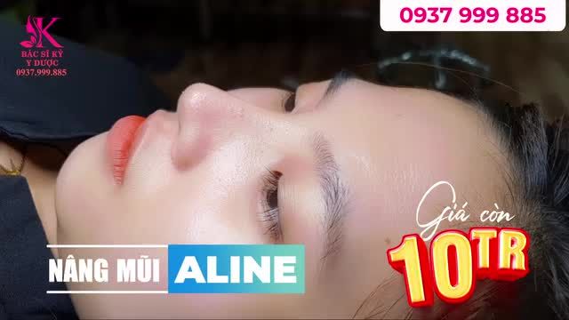 Sở hữu ngay dáng mũi Aline cao thanh với 10 Triệu.