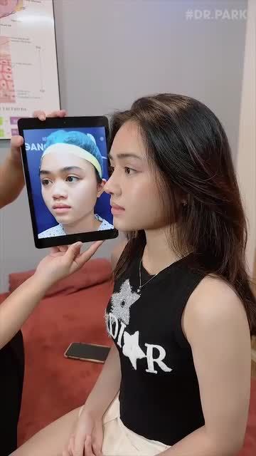 HOÀN THIỆN VẺ ĐẸP CÙNG NÂNG MŨI CẤU TRÚC