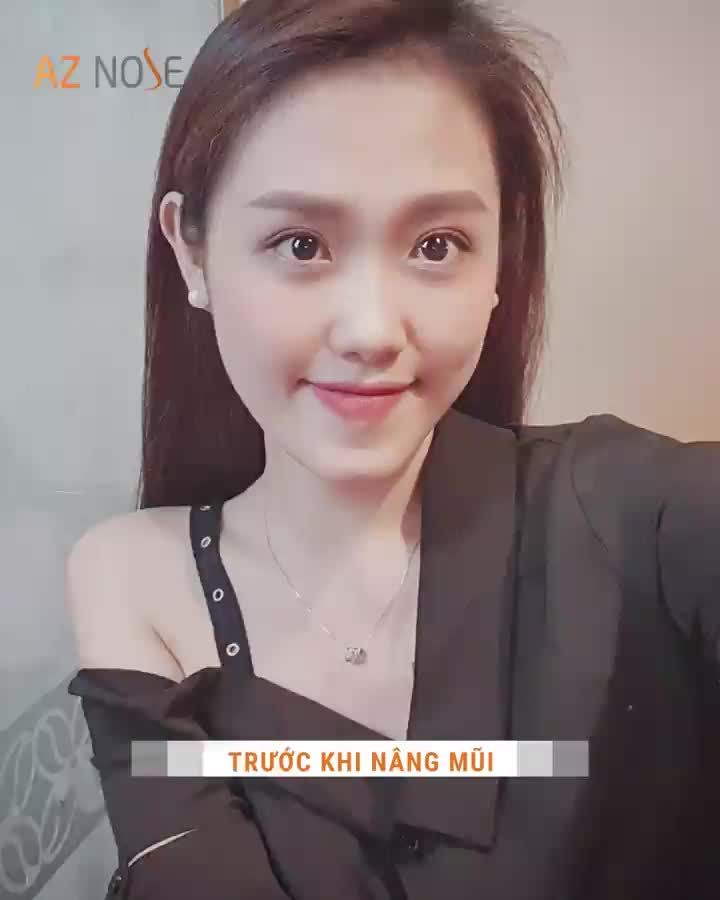 Ở đây có nhiều sự xinh đẹp với dáng mũi hơn 2 năm!