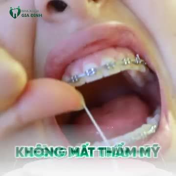 NIỀNG RĂNG LẦN HAI - INVISALIGN LÀ LỰA CHỌN ĐÚNG ĐẮN