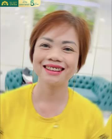 Quyết định lên Hà Nội để làm răng ở Delia, chị Thanh Xuân đã thành công sở hữu nụ cười sáng khỏe, thơm tho như ý sau khi làm thẩm mỹ 20 răng sứ Emax.