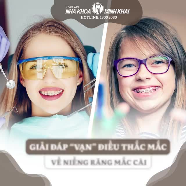 Giải đáp “vạn” điều thắc mắc về niềng răng mắc cài