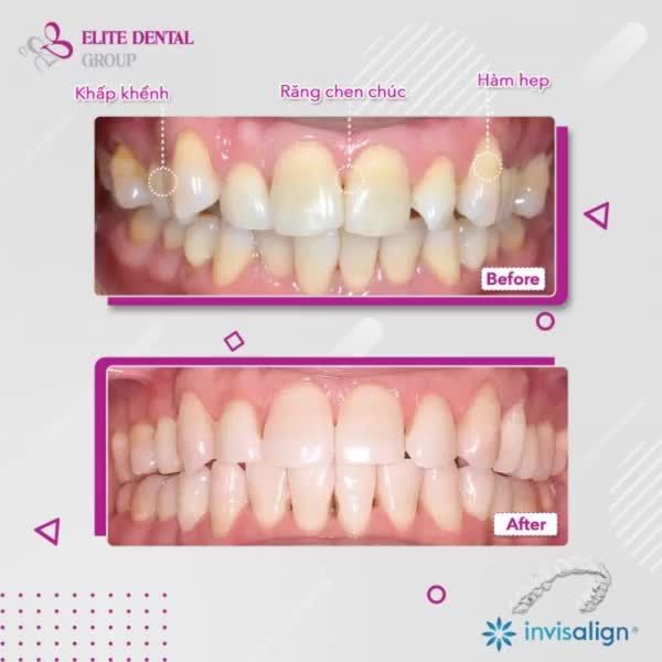 LÀ PHÁI MẠNH BẠN CŨNG CẦN MỘT NỤ CƯỜI ĐẸP