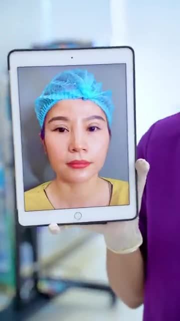 Mí mắt lỗi hỏng được Dr.Hải Lê chỉnh hình thành công như thế nào? Cả nhà cùng theo dõi