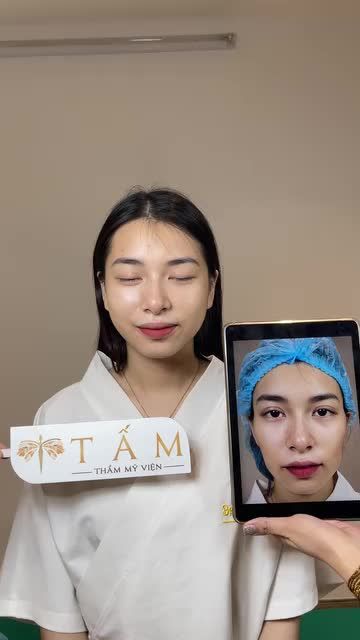 Chỉ sau 30 phút, gương mặt cô bạn đã trở nên đầy đặn cải thiện đáng kể so với hình ảnh trước khi làm