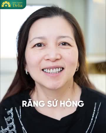 Chỉ 48 giờ hoàn thiện - Răng trắng sáng đẹp tự nhiên