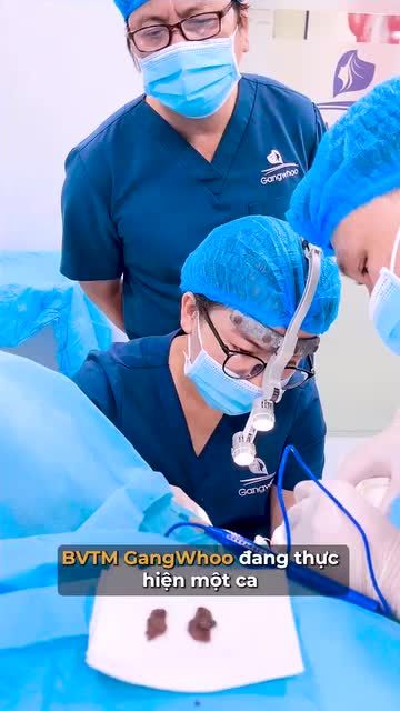 Trẻ hóa vùng yêu an toàn, hiệu quả cùng BVTM Gangwhoo