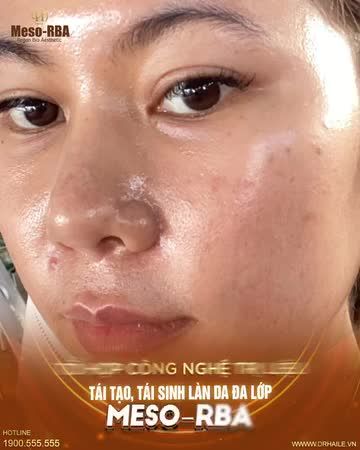 Chi phí vô cùng tiết kiệm, phù hợp với túi tiền của mọi khách hàng!