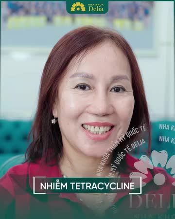 Quyết định từ Quảng Ninh lên Hà Nội để thay đổi nụ cười tại nha khoa Delia