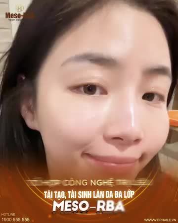 Có "hương" thì cũng cần phải có "sắc" - Nâng tầm nhan sắc, da đẹp rạng rỡ chỉ sau 1 liệu trình thực hiện Meso-RBA tại Dr.Hải Lê!