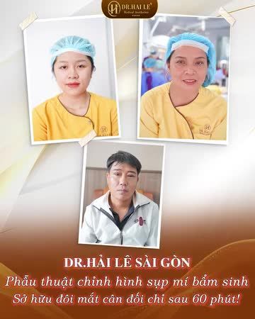  Tạm biệt sụp mí, mắt đẹp hết ý! - Inbox hoặc để lại SĐT nhận ưu đãi HOT từ Dr.Hải Lê!