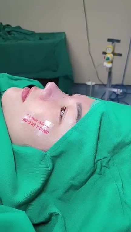 Sở hữu ngay dáng mũi mềm mại, tự nhiên bằng kỹ thuật tiên tiến, hiện đại sẽ giúp khuôn mặt thêm thanh thoát và xinh xắn.
