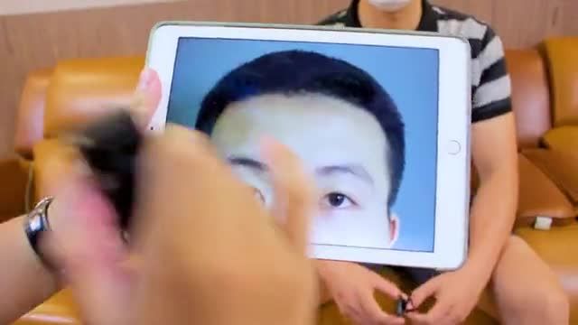 Tuần lễ 20/10 muôn ngàn ưu đãi cho chị em nhưng anh em cũng không kém cạnh đâu cả nhà ơi  Cùng theo dõi kết quả cắt mí vừa thực hiện xong
