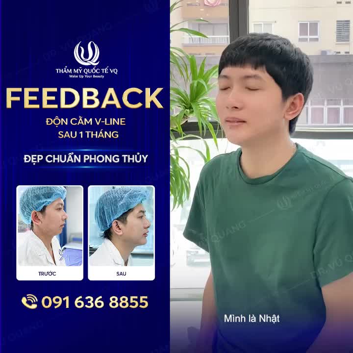 K.H Review Độn cằm Vline - Cằm phong thủy – Tướng thêm sang tại Thẩm mỹ quốc tế VQ.  " Làm xong mình có lộc luôn" K.H chia sẻ (Phút 0:35).