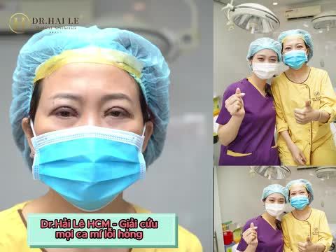 Đặt hoàn toàn niềm tin vào lần sửa mí này tại Dr.Hải Lê cơ sở HCM Và cái kết bất ngờ