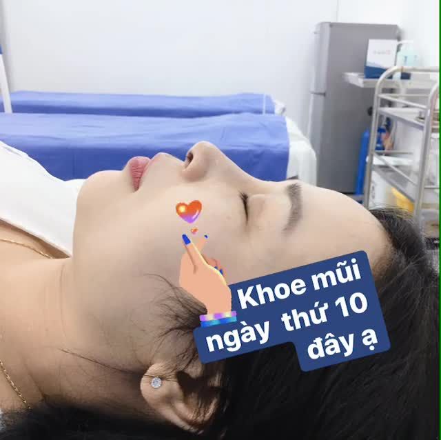 Khách hàng đang trong công đoạn chuẩn bị cắt chị mũi!