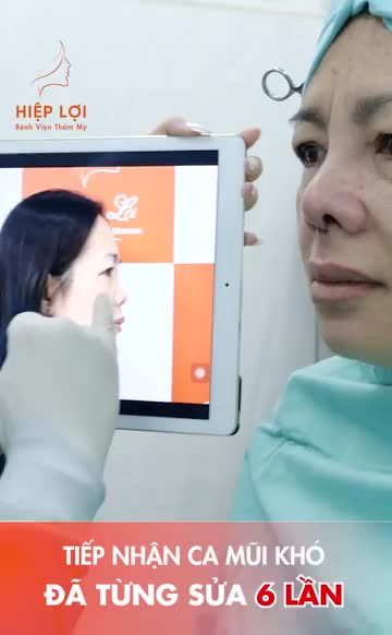 CA MŨI KHÓ, ĐÃ TỪNG SỬA 6 LẦN