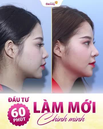 Cái giá của việc mở lòng đôi khi rất đắt. Nhưng cái giá của sự xinh đẹp đôi lúc lại rất rẻ