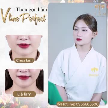 Khách hàng Minh Huyền đặt lịch đến Tấm tư vấn dịch vụ Thon gọn hàm Vline Perfect. Sau khi kiểm tra tình trạng mặt, bác sĩ kết luận bạn phù hợp để sử dụng dịch vụ.