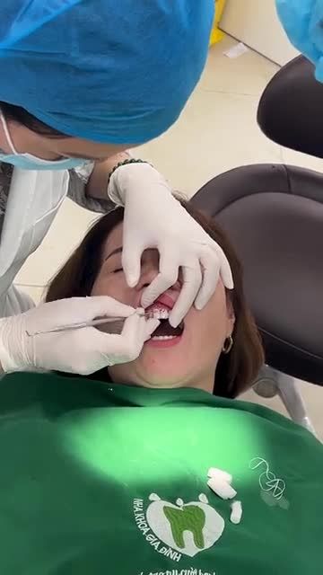 QUÁ TRÌNH THẨM MỸ RĂNG SỨ CHO CHỊ KHÁCH ĐẾN TỪ YÊN BÁI
