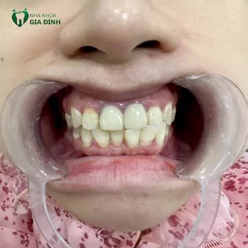 GỬI GẮM ĐÚNG NƠI - GẶT KẾT QUẢ ĐÚNG Ý