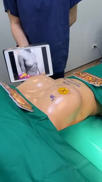 SIÊU PHẨM VÒNG 1 TIẾP THEO