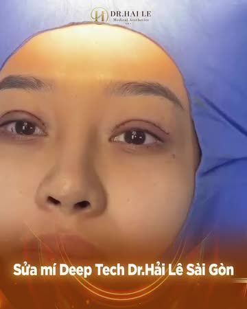 Đôi mắt không còn lờ đờ, mệt mỏi, thiếu sức sống - Trả lại sự tự tin cho vị khách hàng!