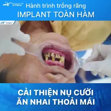 Cuộc sống còn nhiều nỗi lo, nhưng tôi vẫn lựa chọn lo cho mình quyền được sống vui sống khỏe...