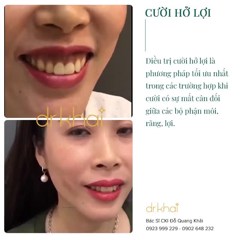 60 PHÚT CHỜ ĐỢI - VĨNH VIỄN TẠM BIỆT CƯỜI HỞ LỢI