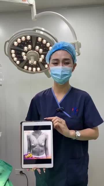 Ca ngực tiếp theo trong ngày