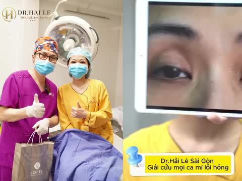 Dr.Hải Lê Sài Gòn giải cứu mọi ca mí lỗi hỏng từ nặng đến rất nặng!