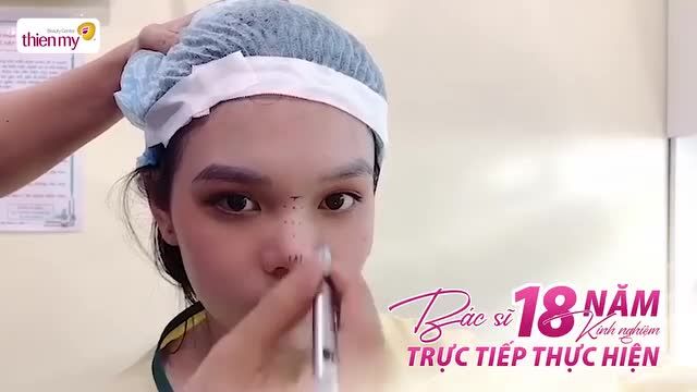 ĐÂY LÀ LÝ DO CHỊ EM “ĐỔ XÔ” ĐI NÂNG MŨI TẠI THIỆN MỸ