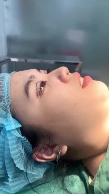 Xong Ca Tạo Hình Mí Cuối Tuần