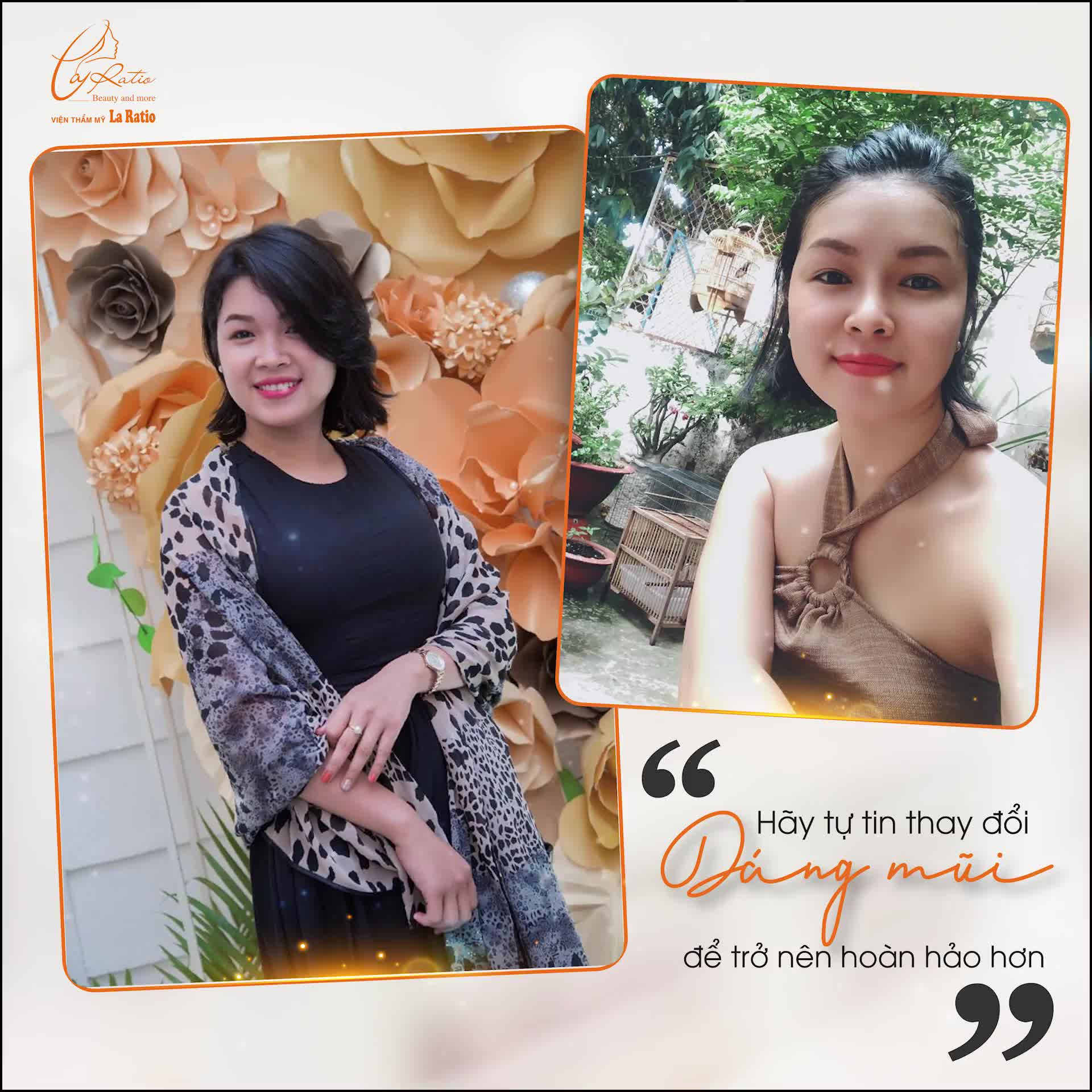 HÃY TỰ TIN THAY ĐỔI DÁNG MŨI CỦA MÌNH