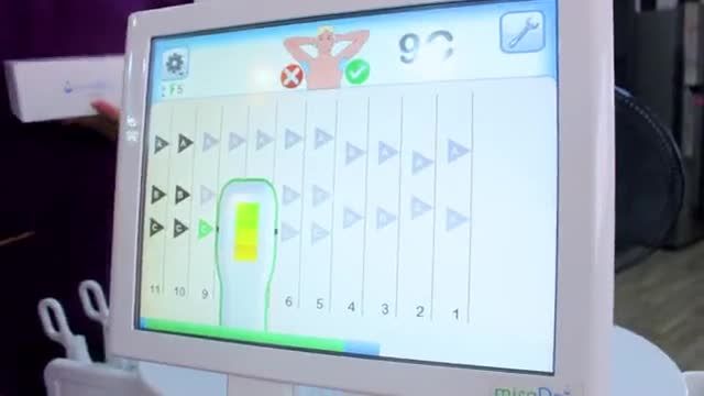 Điều trị hôi nách công nghệ miradry giải pháp hoàn hảo điều trị triệt để tình trạng hôi nách