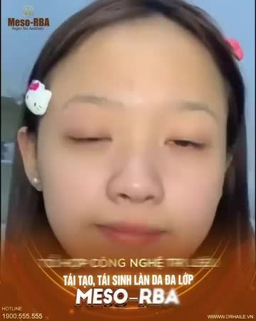 Ứng dụng Tổ hợp công nghệ tiên tiến, hiện đại bậc nhất thế giới vào điều trị các vấn đề về da, giải quyết dứt điểm nhược điểm da: Da dầu, thâm mụn, da thô ráp, xỉn màu, da không đều màu, thiếu sức sống...