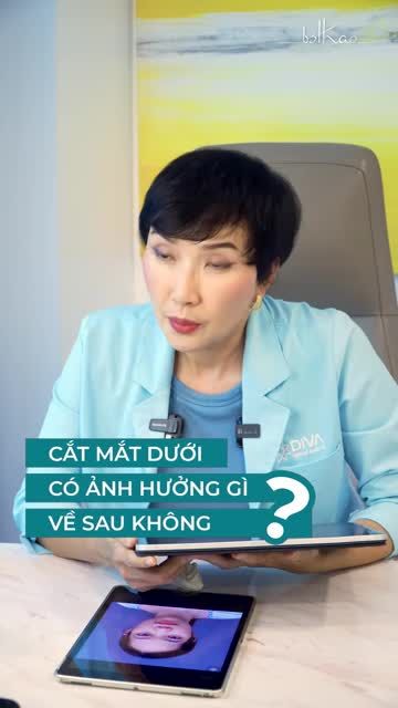 CẮT MÍ MẮT DƯỚI CÓ ẢNH HƯỞNG GÌ VỀ SAU KHÔNG?