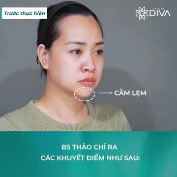 KẾT QUẢTHẨM MỸ: GƯƠNG MẶT THON GỌN, TƯƠI TRẺ CUỐN HÚT