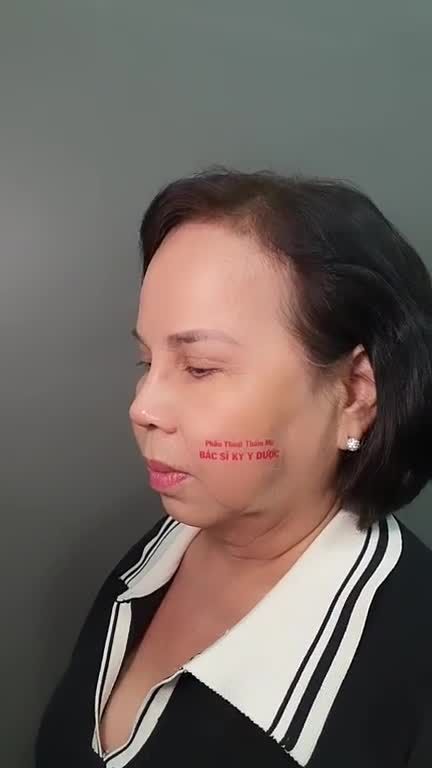 Gửi ngay tình trạng mũi. Tư vấn trực tiếp cùng Bác sĩ Kỳ Y Dược - Giảng viên Đại Học Y Dược TPHCM.