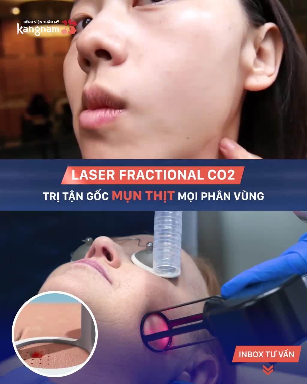 Da sần sùi vì MỤN THỊT - Sáng mịn ngay sau 40 phút