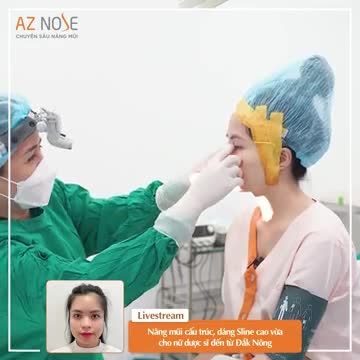Nâng mũi cấu trúc, dáng Sline cao vừa cho nữ dược sĩ ở Đắk Nông.