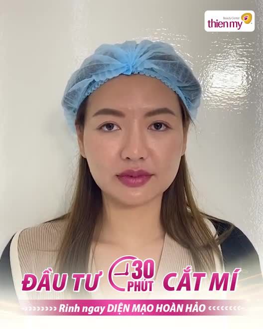 14 NGÀY CẮT MÍ VÀ ĐÂY LÀ KẾT QUẢ