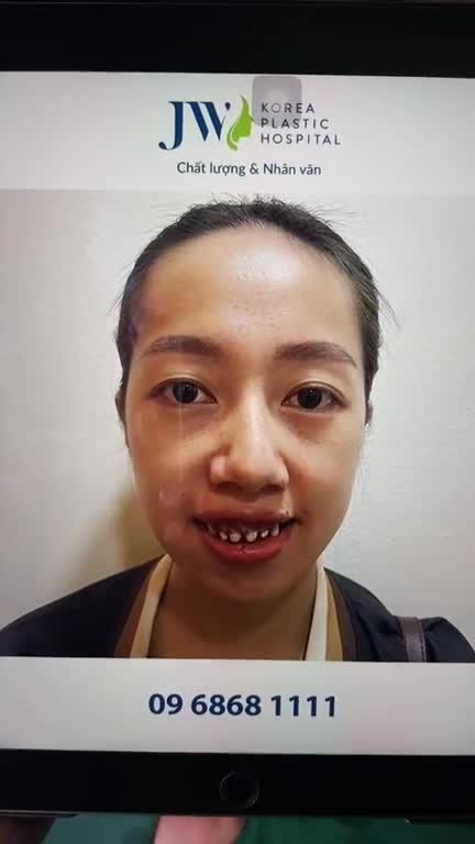 VỠ ÒA Thiếu nữ HÀM HÔ Hơn 20 Năm HẠNH PHÚC PHÁT KHÓC vì thoát kiếp BỊ MIỆT THỊ